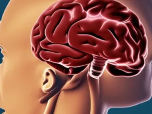 Dlaczego udar mózgu nazywany jest zawałem